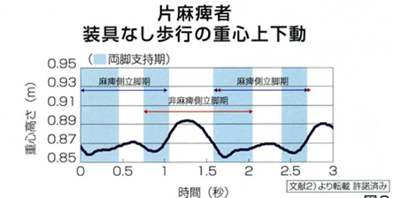 脳卒中片麻痺患者を上手く歩かせる方法 卒中八策 その四 立脚 脳卒中片麻痺患者を上手く歩かせる方法 卒中八策 その四 立脚