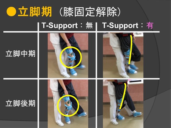 脳卒中片麻痺患者を上手く歩かせる方法 6.T-Supportによる長下肢装具の